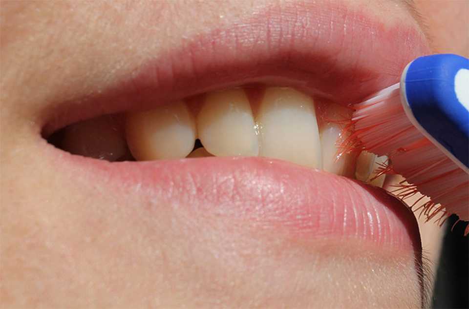 Facts and fiction about your teeth and health